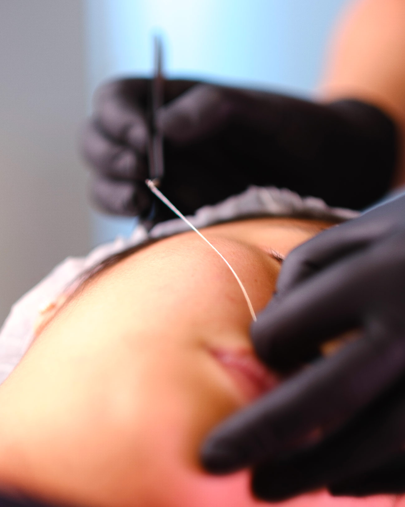 Replump Collagen Technique + RF