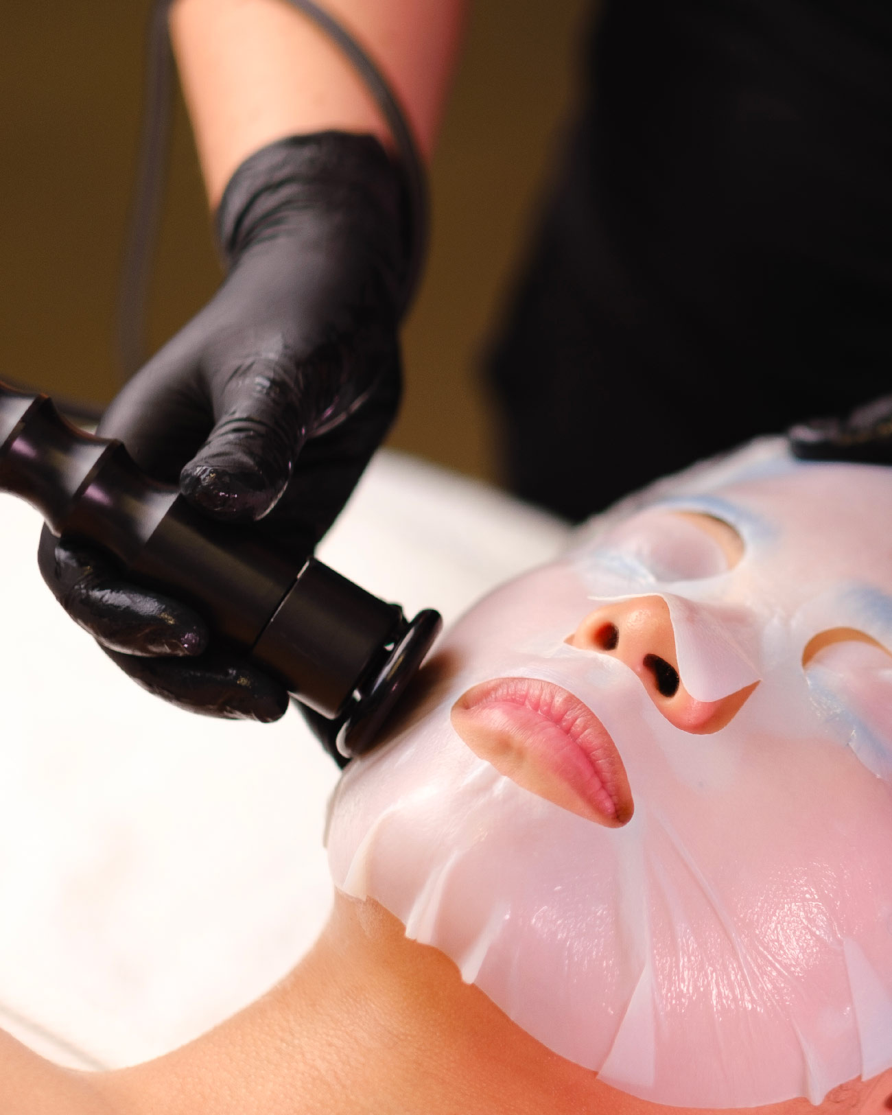 Skintreat+molecola+radiofrequenza